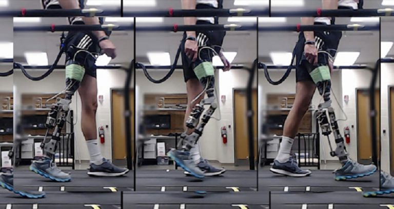 پا به لطف هوش مصنوعی به بیماران کمک ‌می‌کنند که سریع‌تر و بهتر راه بروند - پروتزهای پا به لطف هوش مصنوعی به بیماران کمک ‌می‌کنند که سریع‌تر و بهتر راه بروند
